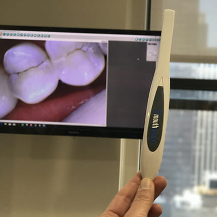 Intraoral Camera at Midtown Dental Excellence